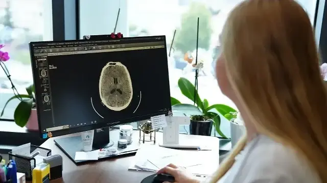 kume bas agrisi nedir belirtileri nelerdir uzmanindan onemli uyarilar gMh2Rqtl.webp